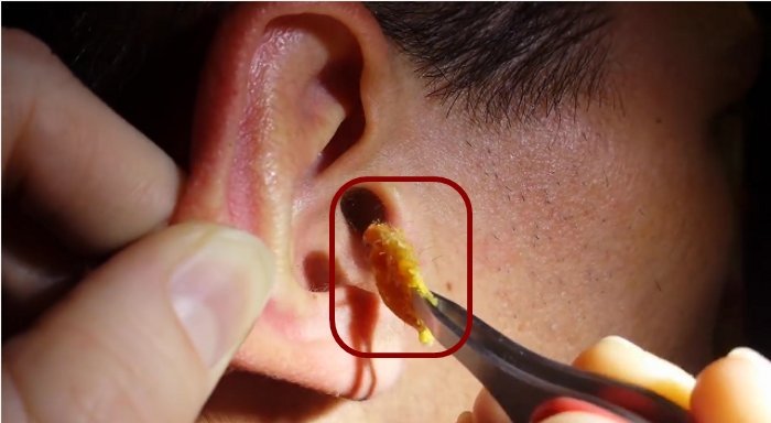 I Never Have Ear Wax 119