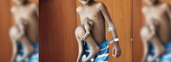 eight_limbed_boy