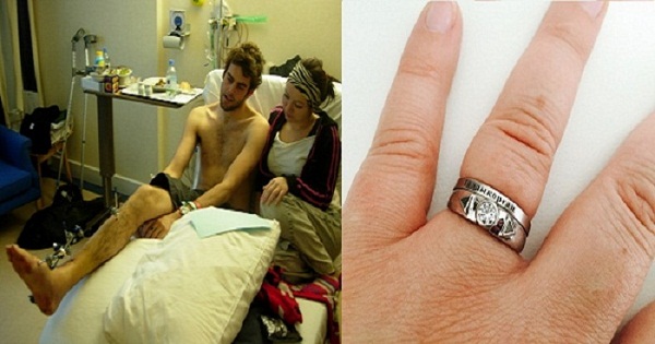 Man Proposes Using Weird Engagement Ring: Made with Bones from His Amputated Leg!